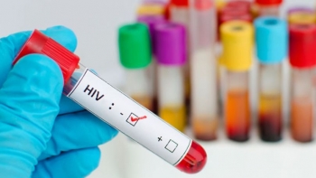 Imagem de Moçambique: 2,6 milhões com VIH/SIDA, uma das principais causas de morte